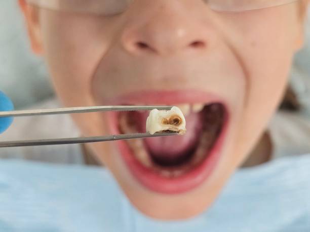Best After-Hours Emergency Dentist in Elroy, NC